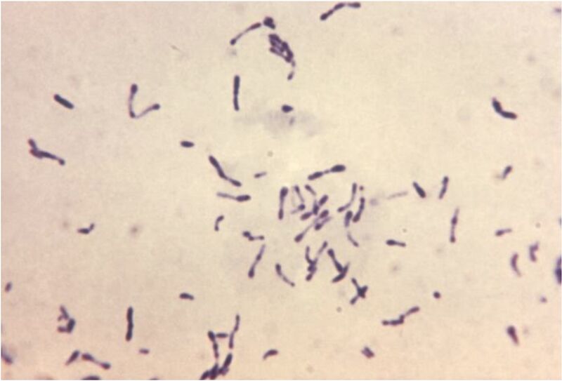 Fichier:Corynebacterium.jpg